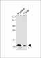 DEFA1 Antibody (Center)