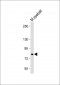 ABCB5 Antibody (N-term)