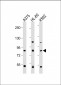 ABCB5 Antibody (N-term)