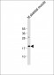 GREMLIN Antibody (C-term)