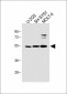 LYK5 Antibody (N-term)