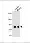 POSTN Antibody (C-term)