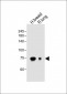 POSTN Antibody (C-term)