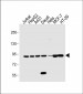 STAT1 Antibody (C-term)