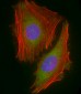 RARRES2 Antibody (N-Term)