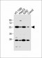 SLC10A1 Antibody (C-term)