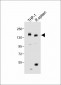 MCSF Receptor (CSF1R) Antibody (C-term)