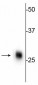 Calbindin Antibody