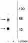 CaM Kinase II (Thr306) Antibody