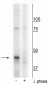 CK1Mt (Tyr153) Antibody