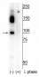 CtIP (Ser326) Antibody