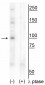 CtIP (Thr847) Antibody