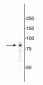 EWS Antibody