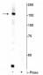 FANCI (Ser556) Antibody