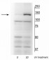 FANCI (Ser559) Antibody