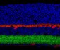 GABAA Receptor ß3 Antibody