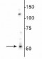 GABAA Receptor ß3 Antibody