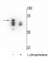 Hsp70 (Ser153) Antibody