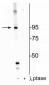 Insulin Receptor (Thr1160) Antibody