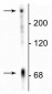 Microtubule Associated Protein 2 C/D (MAP2C/D) Antibody