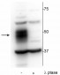 MEF2C (Ser222) Antibody