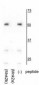 Mnk2a Antibody