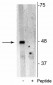 p62 (Ser28) Antibody