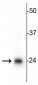 TFAM (Transcription Factor A, motochondrial) Antibody