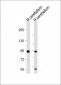 TRPV1 Antibody (N-term)