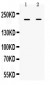 Anti-BRCA1 Picoband Antibody