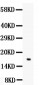 Anti-Angiogenin/ANG Picoband Antibody