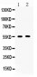 Anti-CD147/Emmprin Picoband Antibody