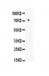 Anti-MMP2 Picoband Antibody