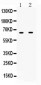 Anti-IFNAR1 Picoband Antibody