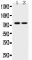 Anti-KCNQ1 Picoband Antibody