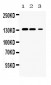 Anti-JAK1 Picoband Antibody