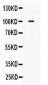 Anti-Calpastatin Picoband Antibody