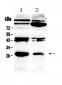 Anti-PDGF beta Picoband Antibody