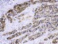 Anti-Cytokeratin 5 Picoband Antibody