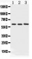 Anti-Cytokeratin 5 Picoband Antibody