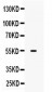 Anti-MMP-13 Picoband Antibody