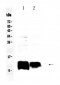 Anti-Beta 2 Microglobulin Picoband Antibody