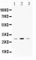 Anti-HLA-DPB1 Picoband Antibody