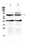 Anti-TSH Receptor Picoband Antibody