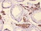 Anti-CYP17A1 Picoband Antibody
