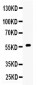 Anti-CYP17A1 Picoband Antibody