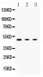 Anti-PRKAR1A Picoband Antibody