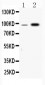 Anti-Fibrinogen alpha chain Picoband Antibody