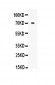 Anti-Angiopoietin-1 Picoband Antibody