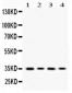 Anti-MC1 Receptor Picoband Antibody